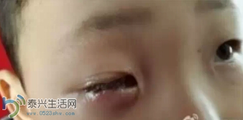 234438rmz73ai7cc332vcn.png