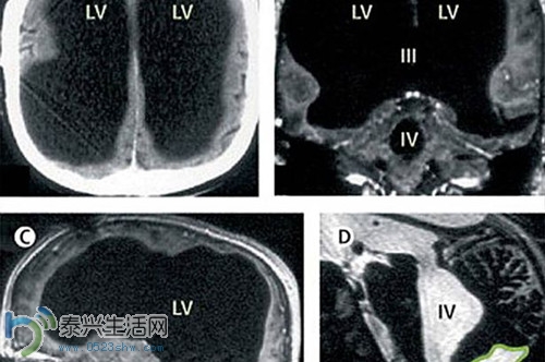 40174353-2945-4211-b1e0-b03d05200099_size54_w500_h332.jpg